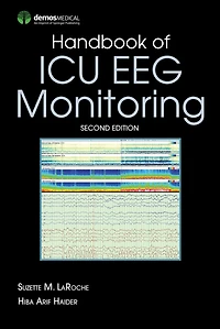 Handbook of ICU EEG Monitoring