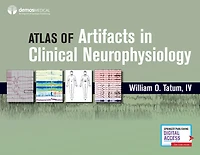 Atlas of Artifacts Clinical Neurophysiology