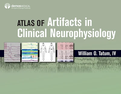 Atlas of Artifacts Clinical Neurophysiology