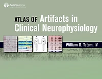 Atlas of Artifacts Clinical Neurophysiology