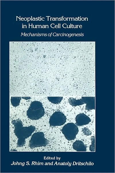 Neoplastic Transformation Human Cell Culture: Mechanisms of Carcinogenesis