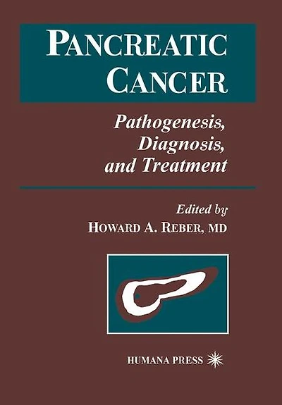 Pancreatic Cancer: Pathogenesis, Diagnosis, and Treatment