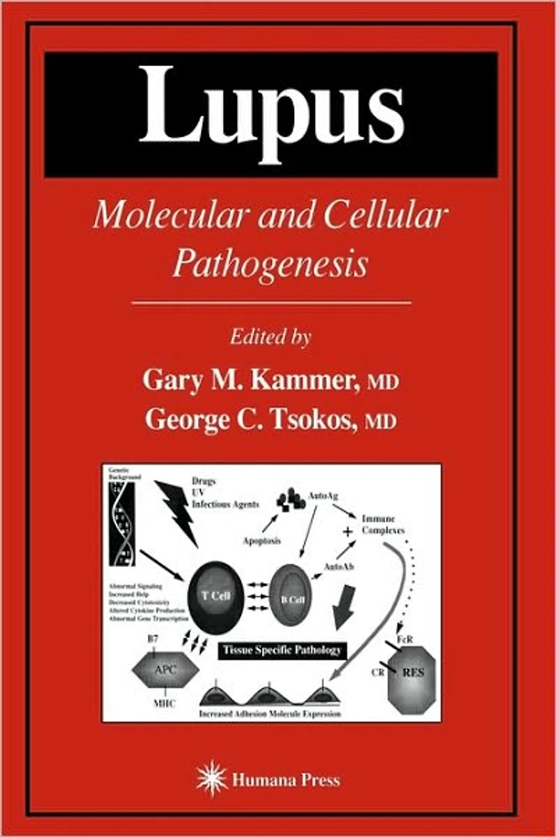 Lupus: Molecular and Cellular Pathogenesis