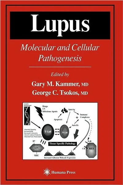 Lupus: Molecular and Cellular Pathogenesis