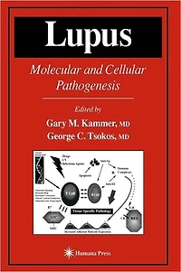 Lupus: Molecular and Cellular Pathogenesis