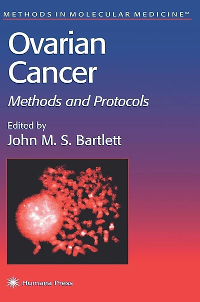 Ovarian Cancer: Methods and Protocols