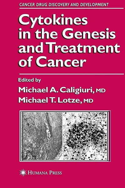 Cytokines the Genesis and Treatment of Cancer
