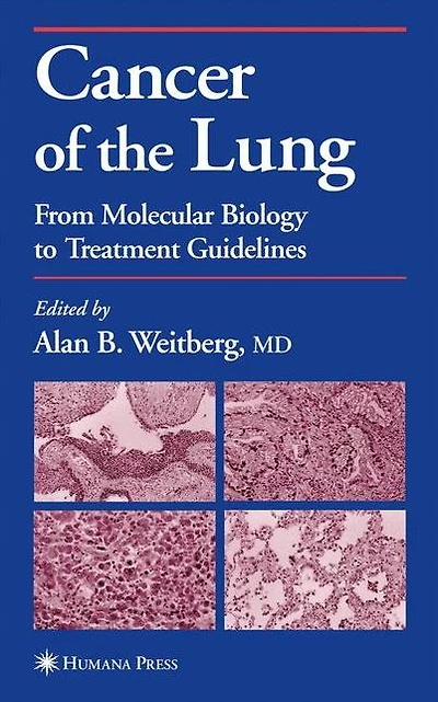 Cancer of the Lung: From Molecular Biology to Treatment Guidelines