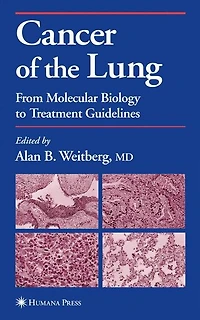Cancer of the Lung: From Molecular Biology to Treatment Guidelines