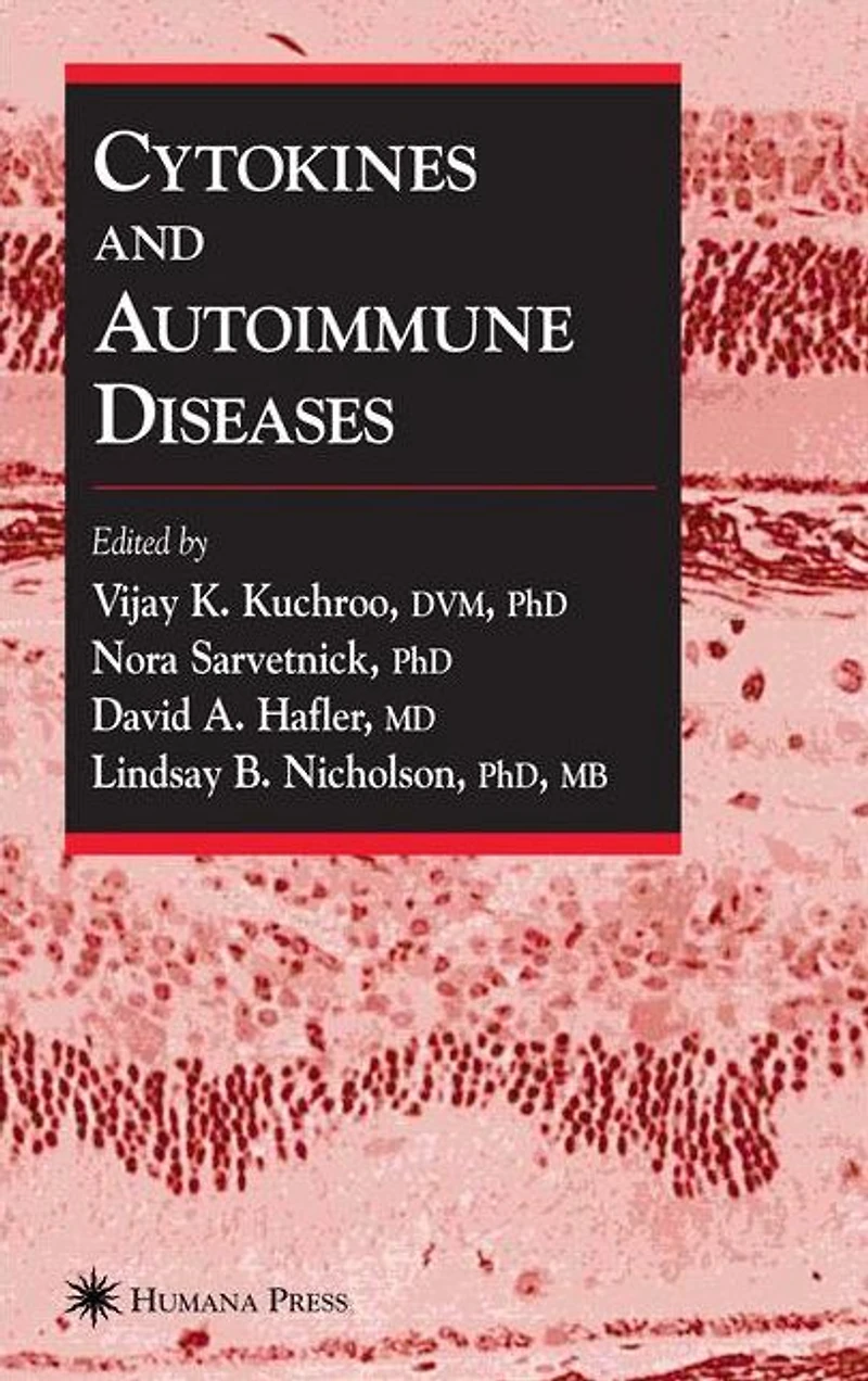 Cytokines and Autoimmune Diseases