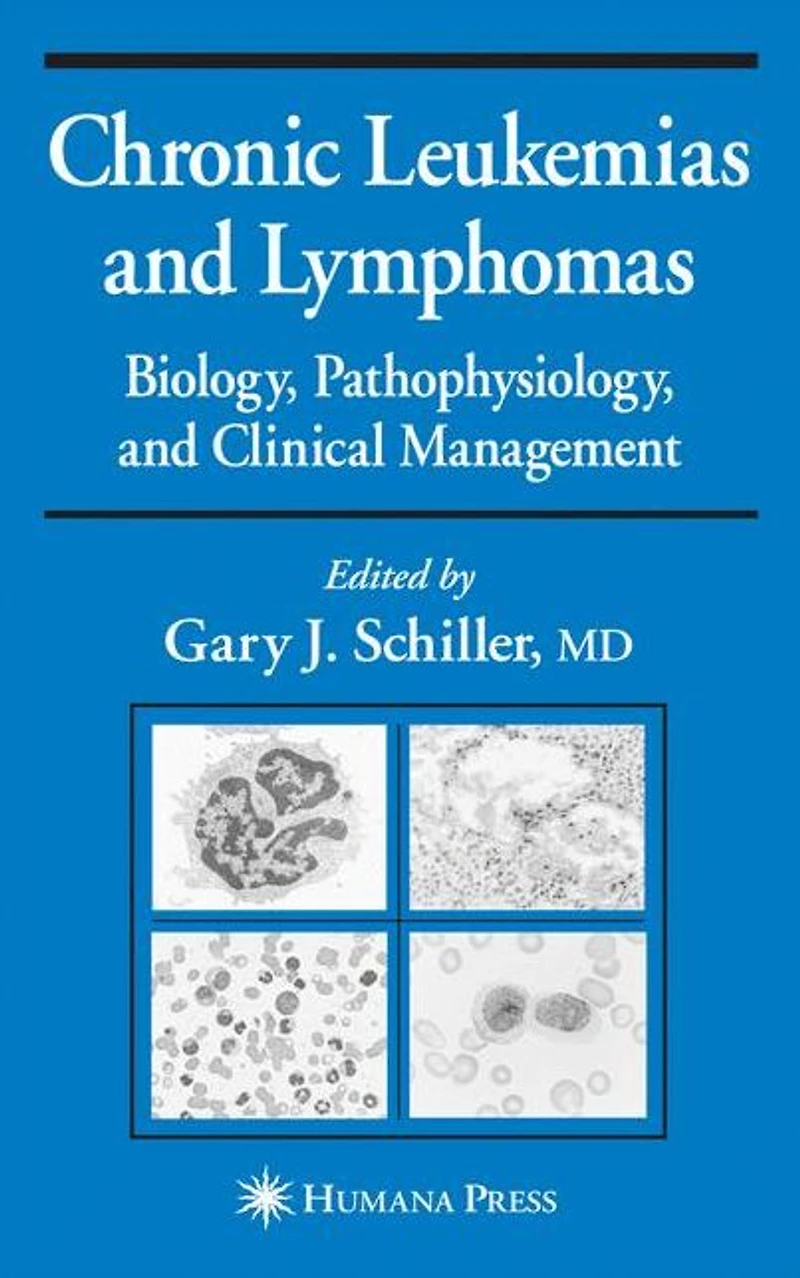 Chronic Leukemias and Lymphomas: Biology, Pathophysiology, and Clinical Management