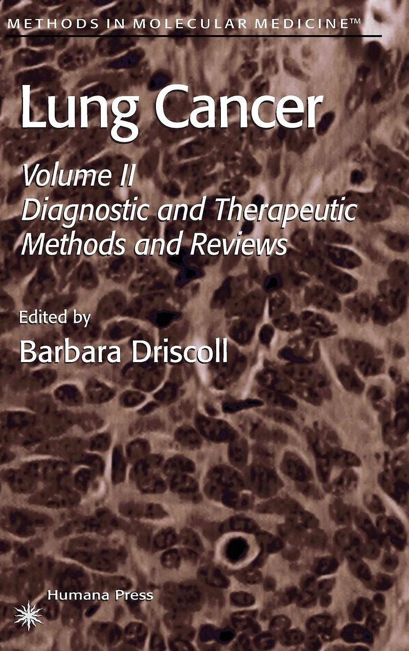 Lung Cancer: Volume 2: Diagnostic and Therapeutic Methods Reviews