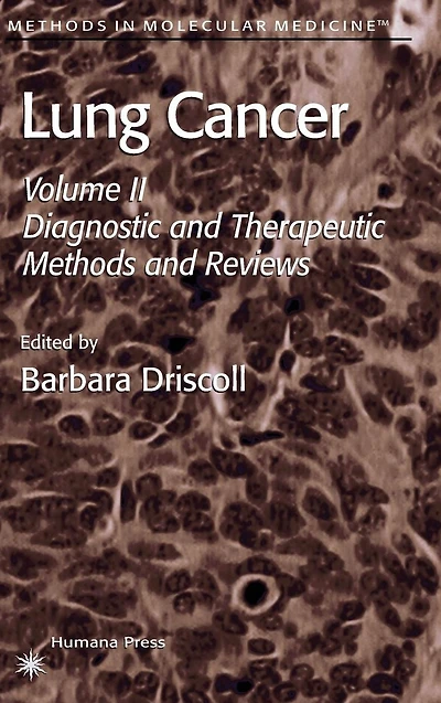Lung Cancer: Volume 2: Diagnostic and Therapeutic Methods Reviews