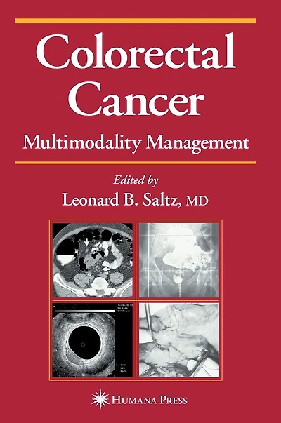 Colorectal Cancer: Multimodality Management