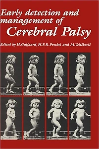 Early Detection and Management of Cerebral Palsy