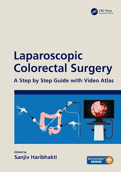 Laparoscopic Colorectal Surgery: A Step by Guide with Video Atlas