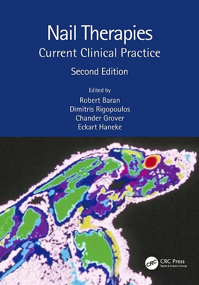 Nail Therapies: Current Clinical Practice