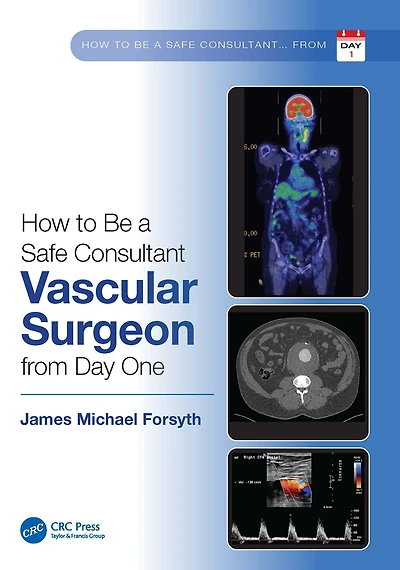 How to be a Safe Consultant Vascular Surgeon from Day One: the Unofficial Guide Passing FRCS (VASC)