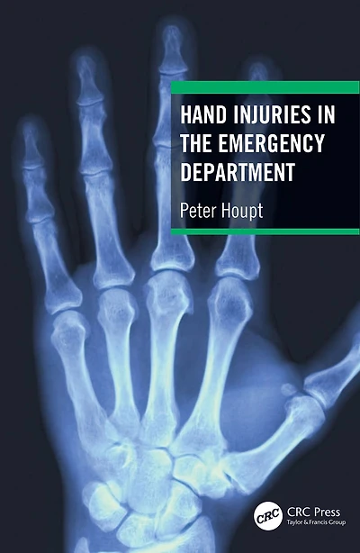 Hand Injuries the Emergency Department