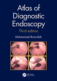 Atlas of Diagnostic Endoscopy, 3E