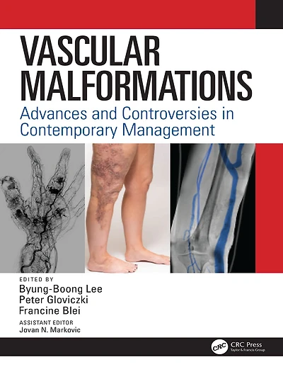Vascular Malformations: Advances and Controversies Contemporary Management
