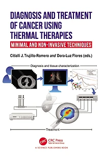 Diagnosis and Treatment of Cancer using Thermal Therapies: Minimal Non-invasive Techniques