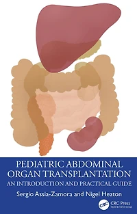 Pediatric Abdominal Organ Transplantation: An Introduction and Practical guide