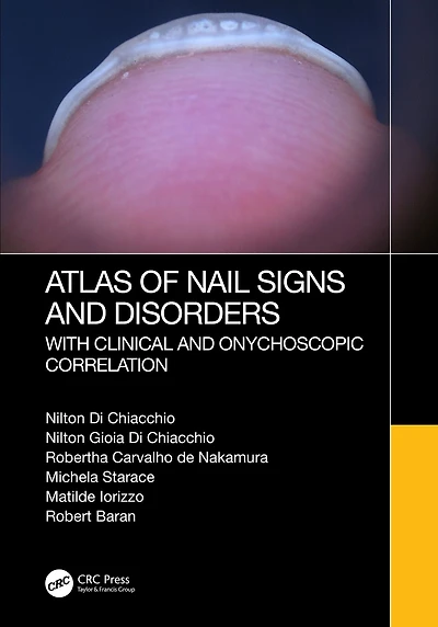 Atlas of Nail Signs and Disorders with Clinical Onychoscopic Correlation