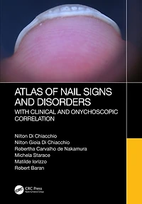 Atlas of Nail Signs and Disorders with Clinical Onychoscopic Correlation