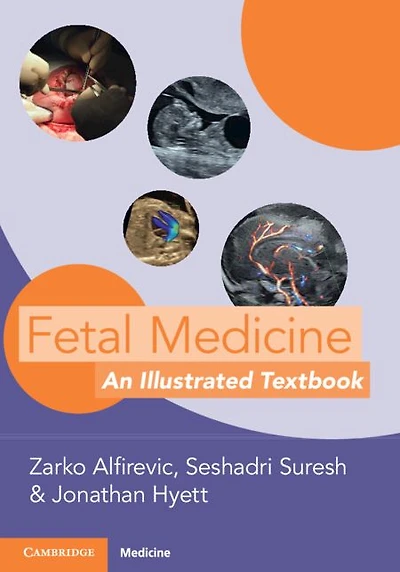 Fetal Medicine: An Illustrated Textbook