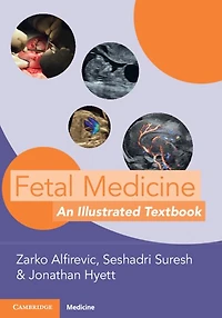 Fetal Medicine: An Illustrated Textbook
