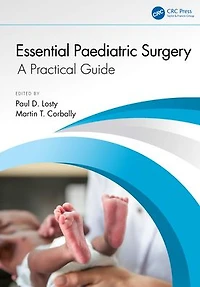 Essential Paediatric Surgery: A Practical Guide