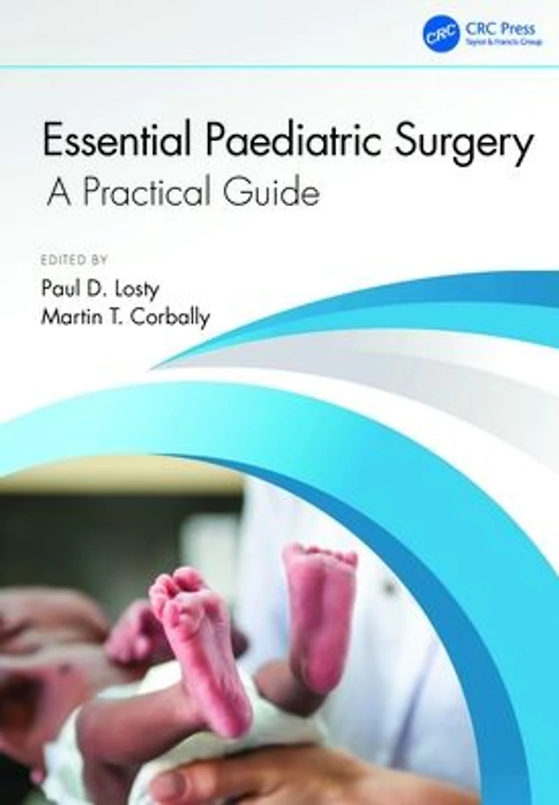 Essential Paediatric Surgery: A Practical Guide
