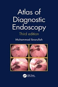 Atlas of Diagnostic Endoscopy, 3E