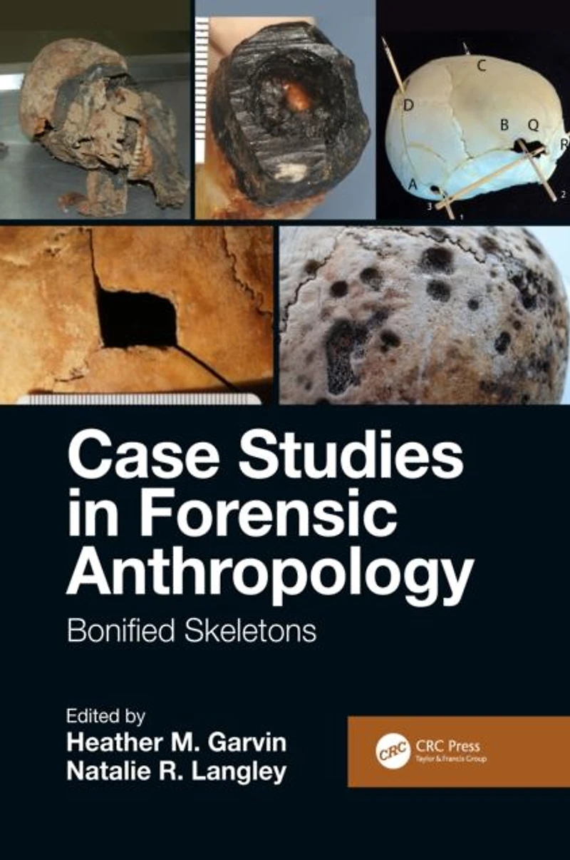 Case Studies Forensic Anthropology: Bonified Skeletons