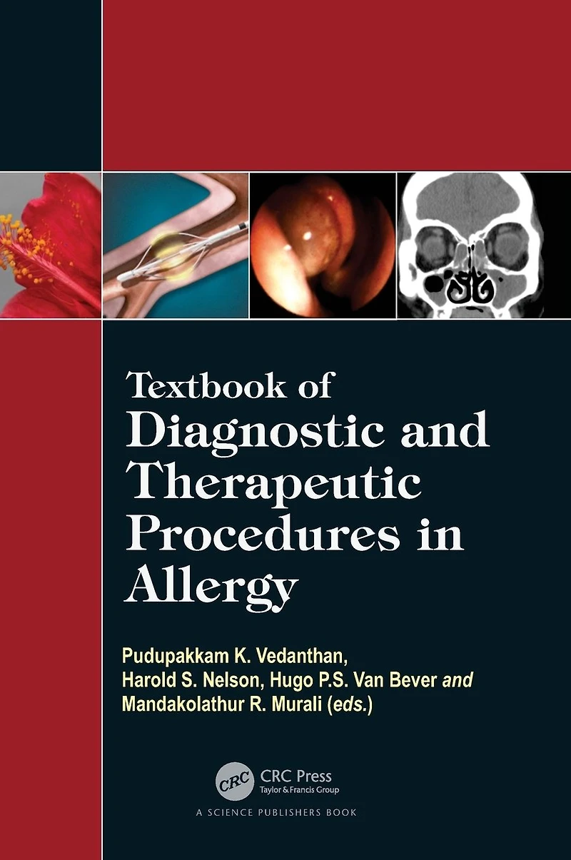 Textbook of Diagnostic and Therapeutic Procedures Allergy