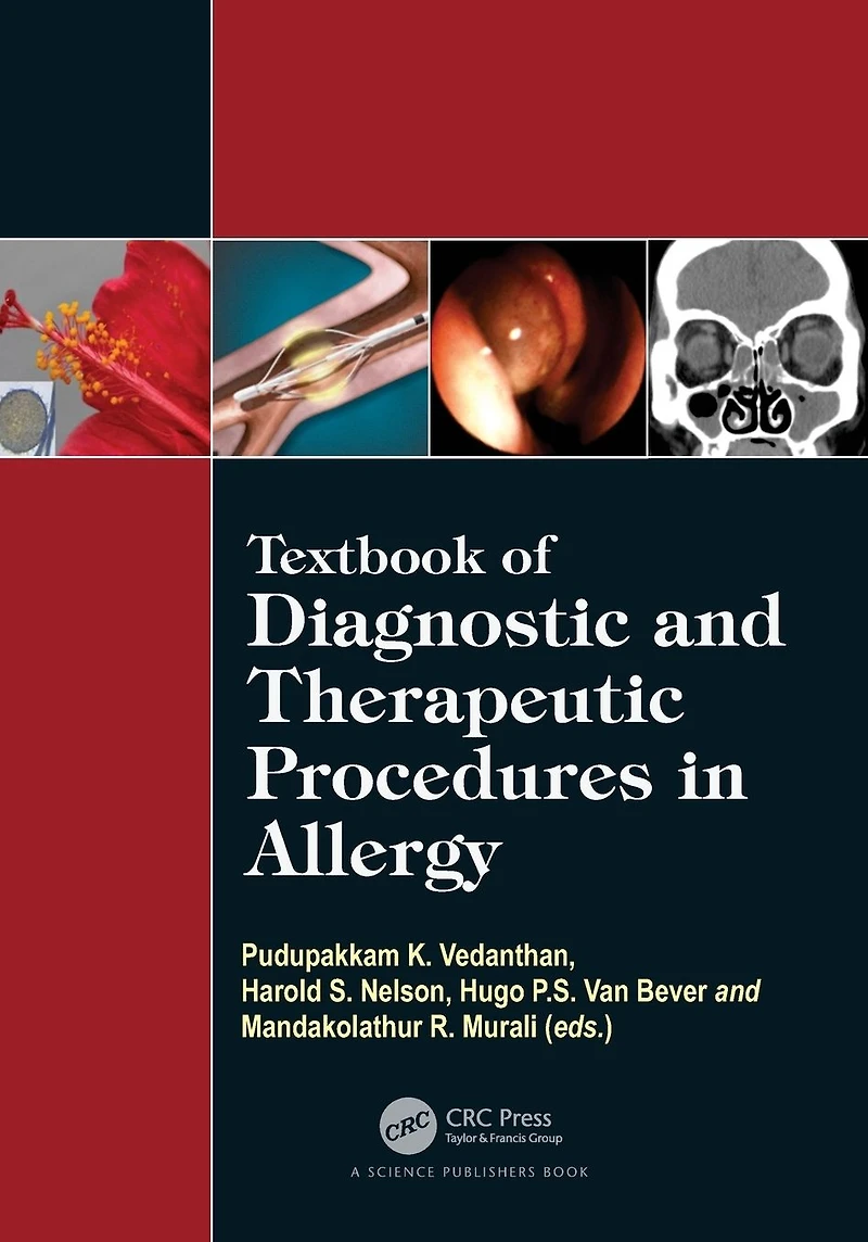 Textbook of Diagnostic and Therapeutic Procedures Allergy