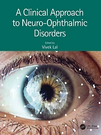 A Clinical Approach to Neuro-Ophthalmic Disorders