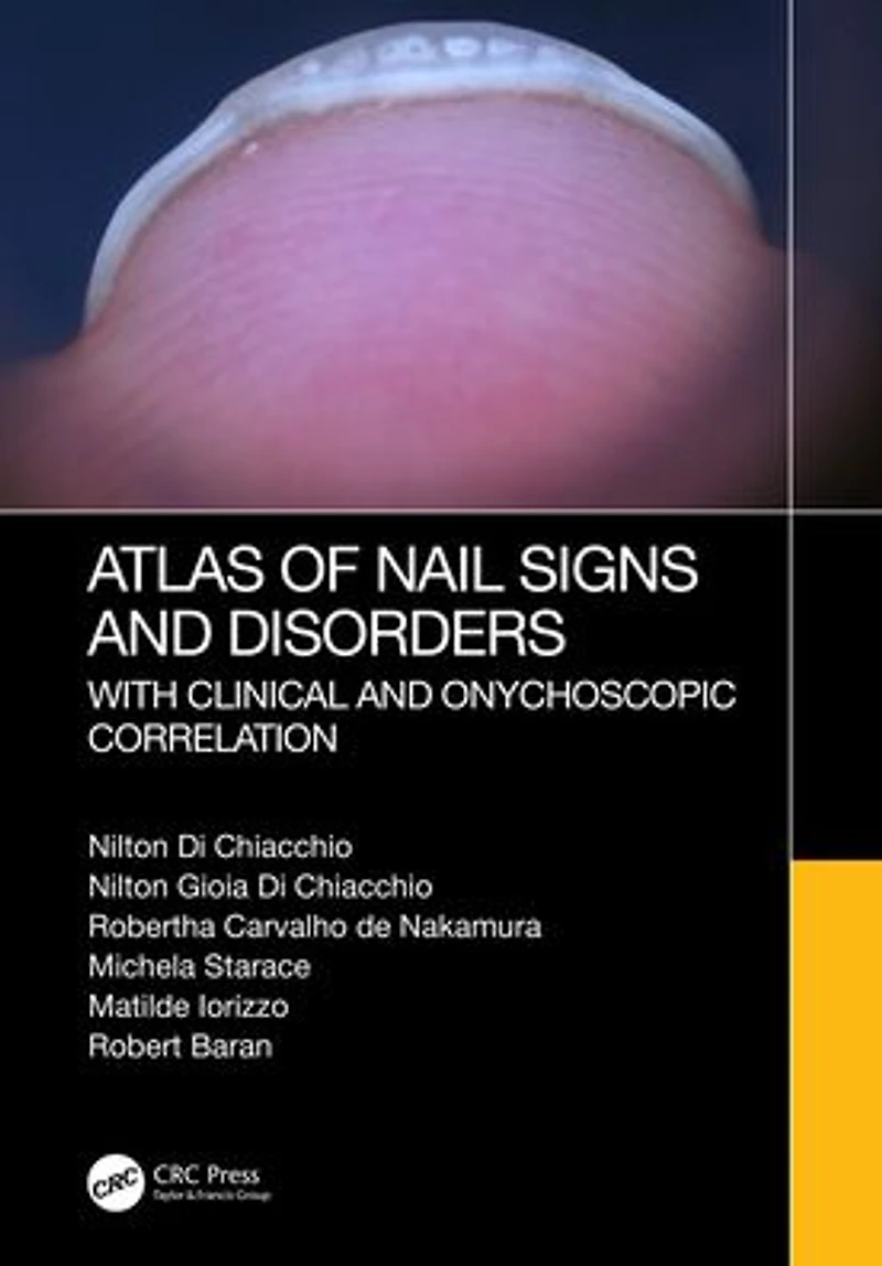 Atlas of Nail Signs and Disorders with Clinical Onychoscopic Correlation