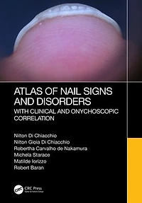 Atlas of Nail Signs and Disorders with Clinical Onychoscopic Correlation