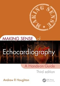 Making Sense of Echocardiography: A Hands-on Guide