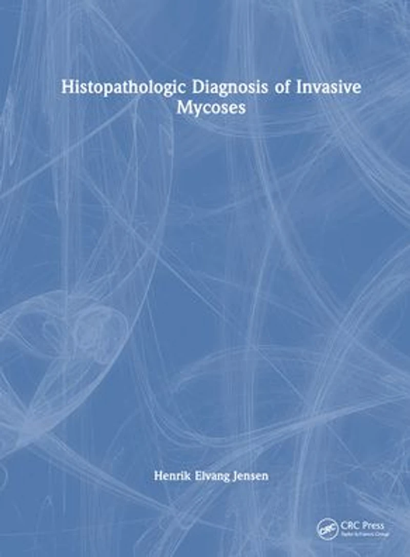 Histopathologic Diagnosis of Invasive Mycoses