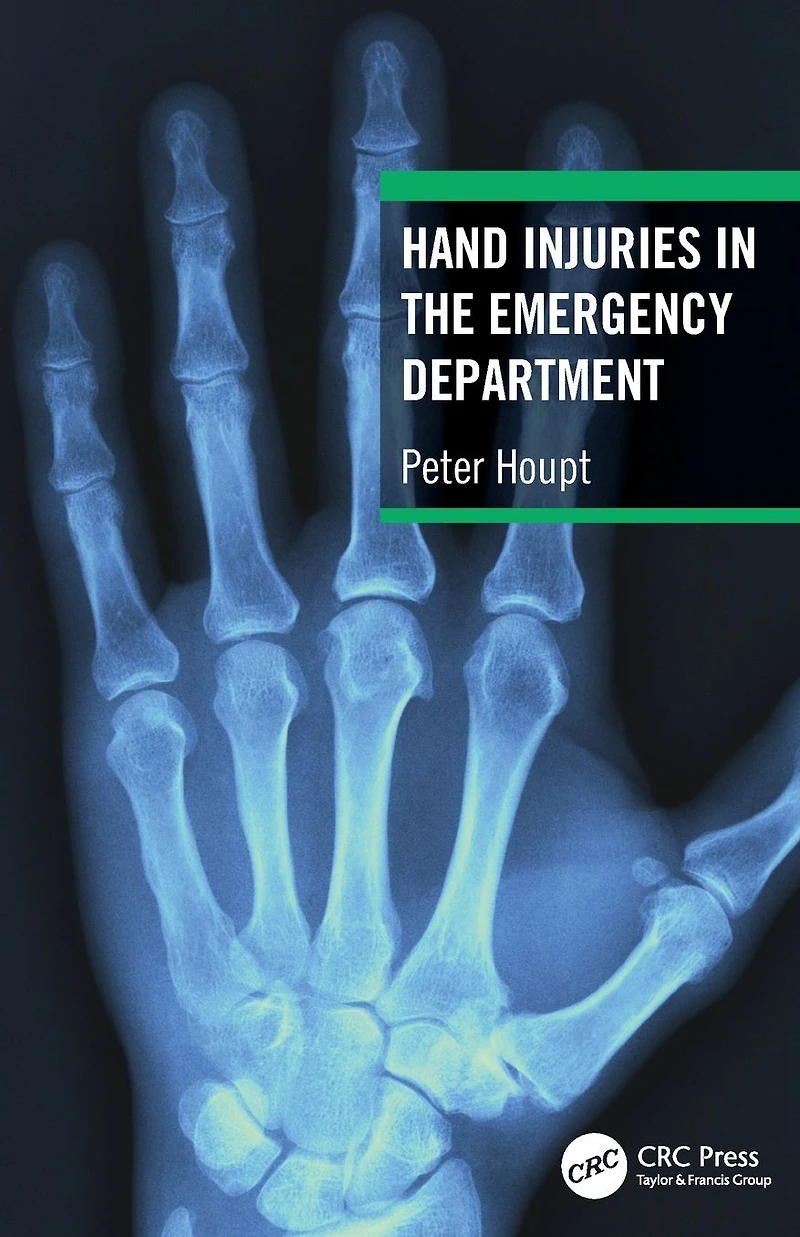 Hand Injuries the Emergency Department