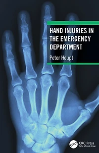 Hand Injuries the Emergency Department