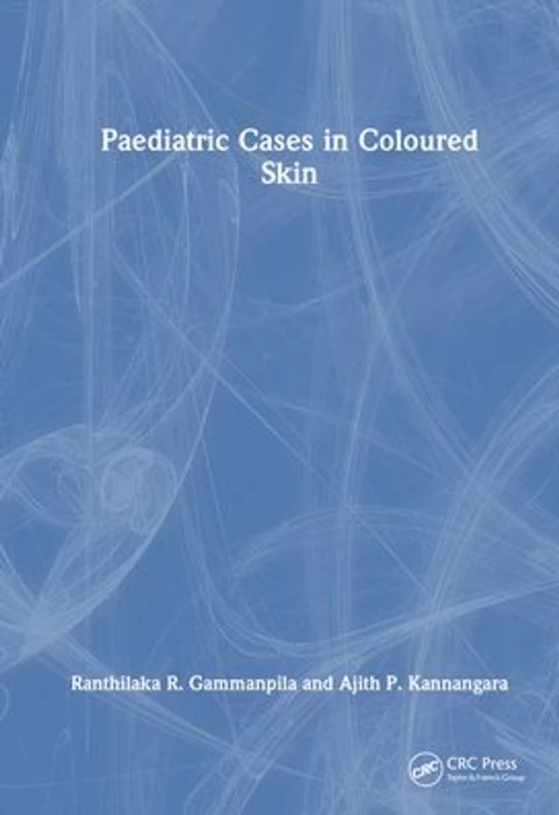 Paediatric Cases Coloured Skin