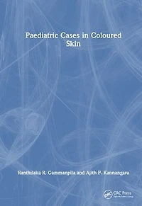 Paediatric Cases Coloured Skin