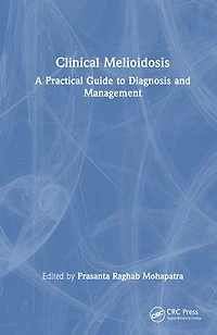 Clinical Melioidosis: A Practical Guide to Diagnosis and Management