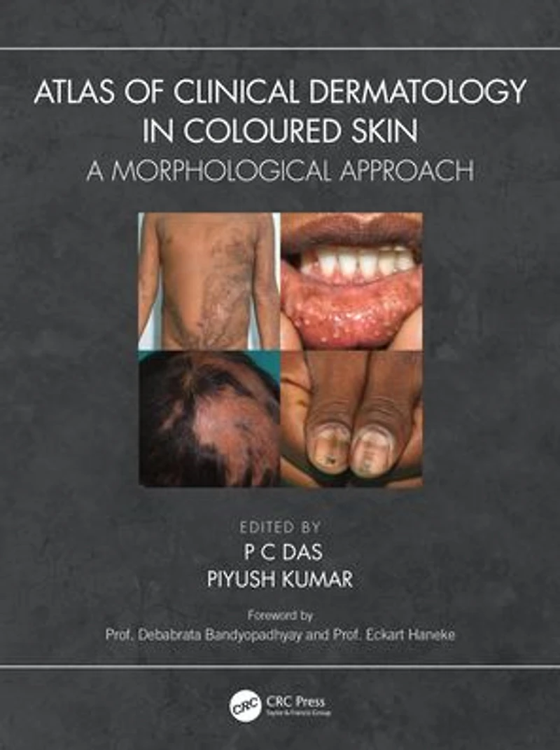 Atlas of Clinical Dermatology Coloured Skin: A Morphological Approach