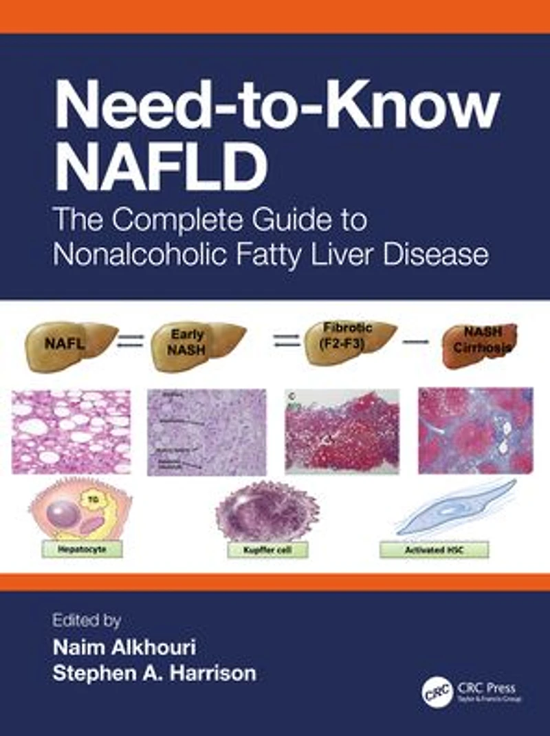 Need-to-Know NAFLD: The Complete Guide to Nonalcoholic Fatty Liver Disease