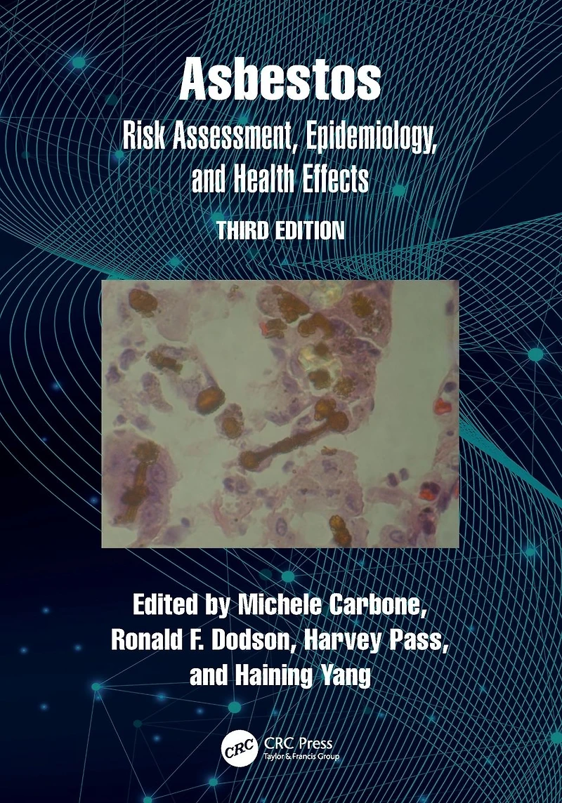 Asbestos: Risk Assessment, Epidemiology, and Health Effects